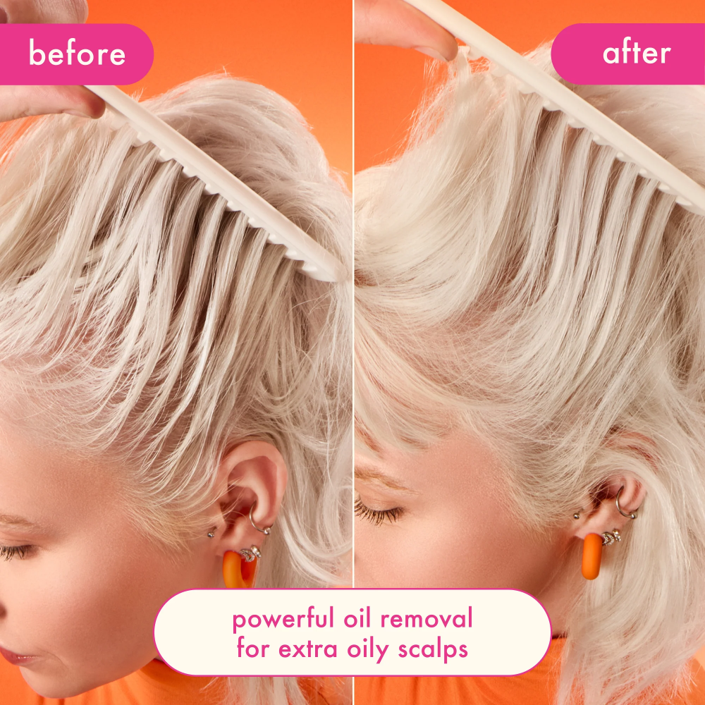 Dry shampoo before-and-after hair photo showing less oil on the after side