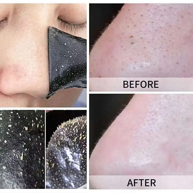 Black Charcoal Pore Cleansing Strips
