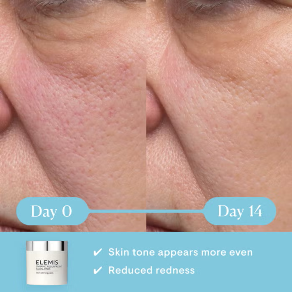 Facial skin close-up with visible redness and smoothing comparison
