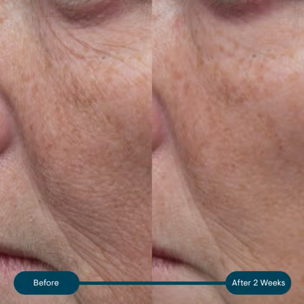 Facial skin close-up with before-and-after results panel