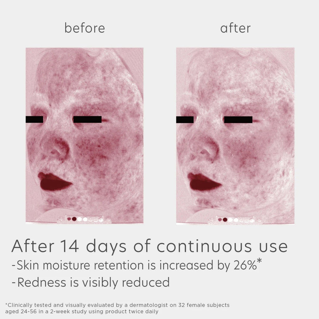 Before-and-after skin results panel with pink skin texture images