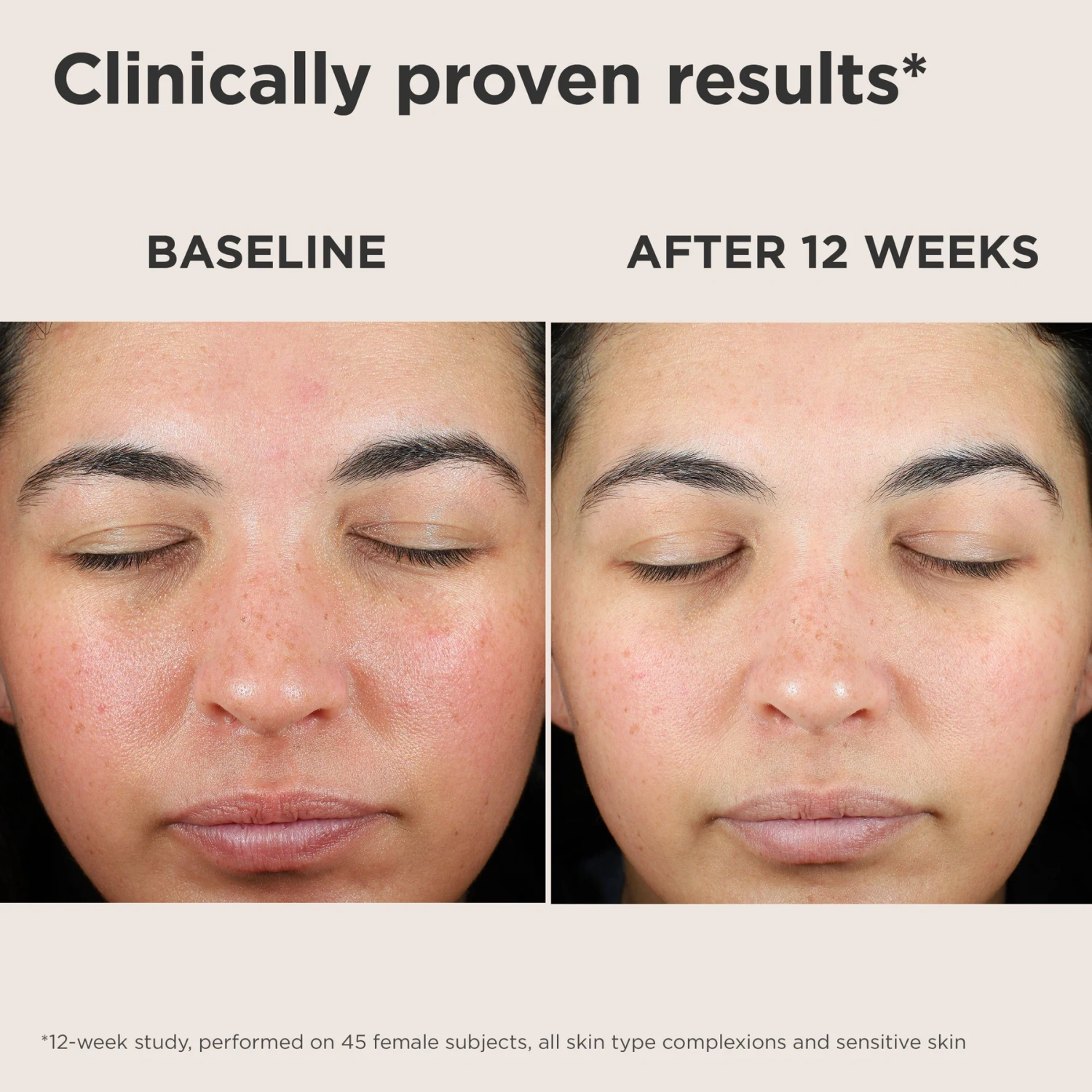 EltaMD UV Skin Recovery SPF 50 sunscreen on face, baseline and after