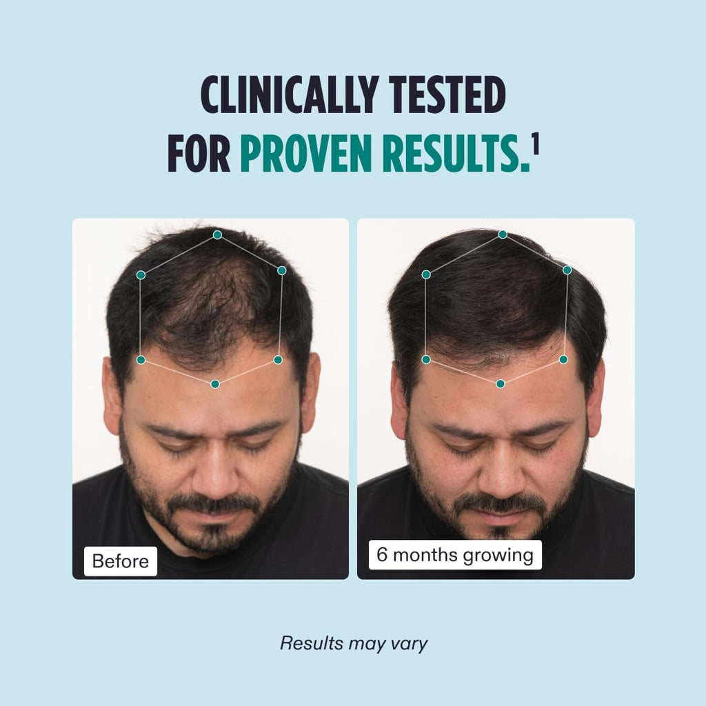 Clinically tested hair growth supplement before-and-after scalp photo panels.