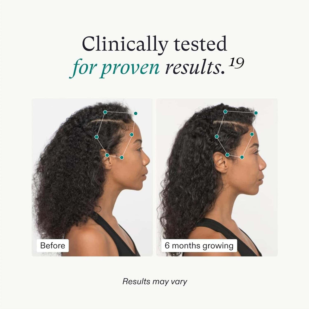 Hair growth comparison graphic with two woman portraits showing before and after