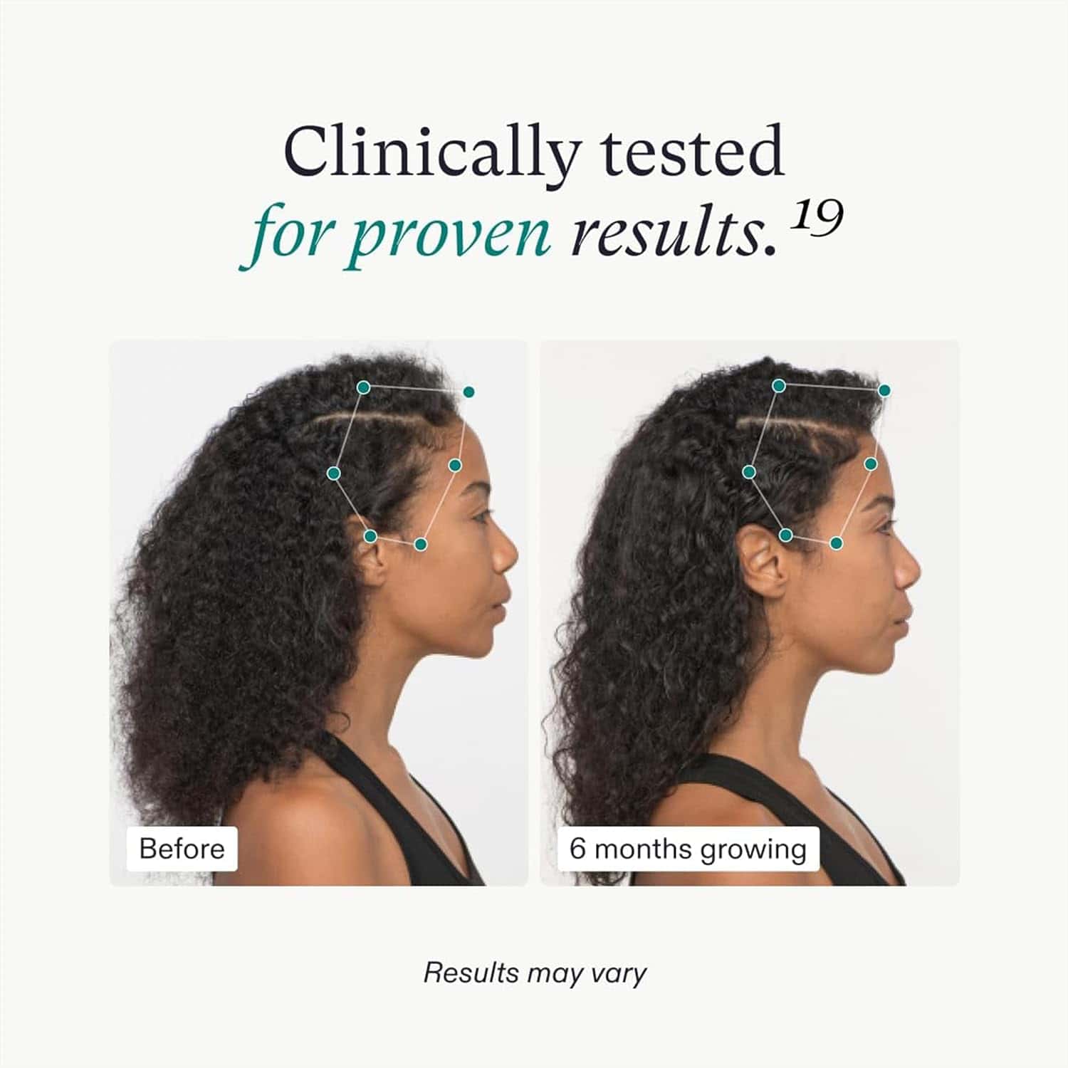 Hair growth comparison graphic with two woman portraits showing before and after