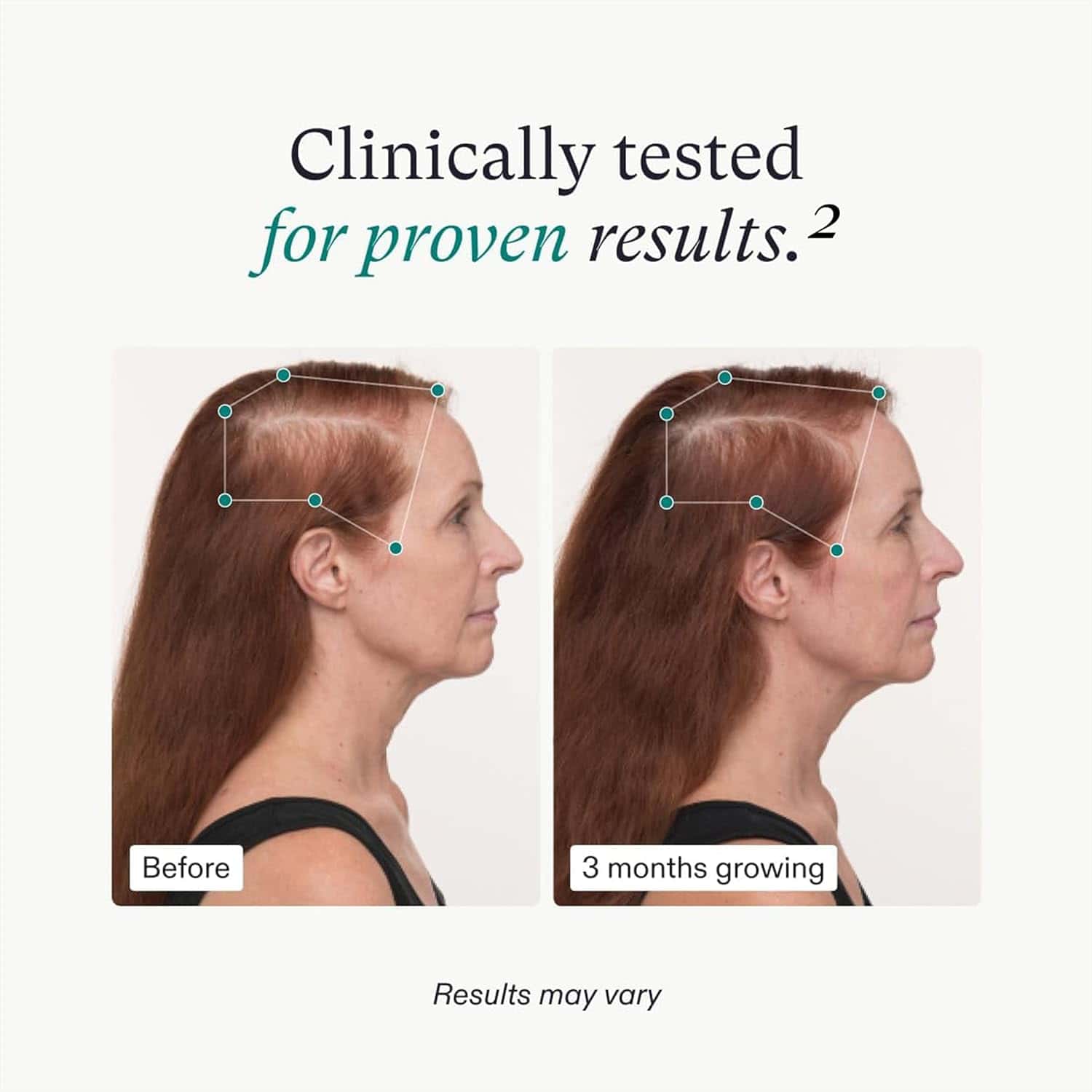 Nutrafol Women’s Balance clinically tested results with before-and-after hair photos