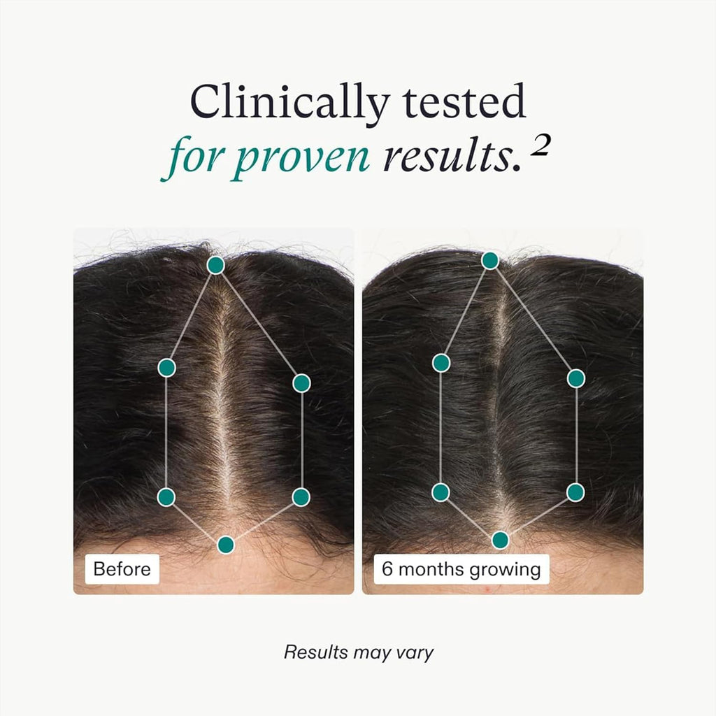 Hair growth clinically tested results chart with before and 6-month scalp photos