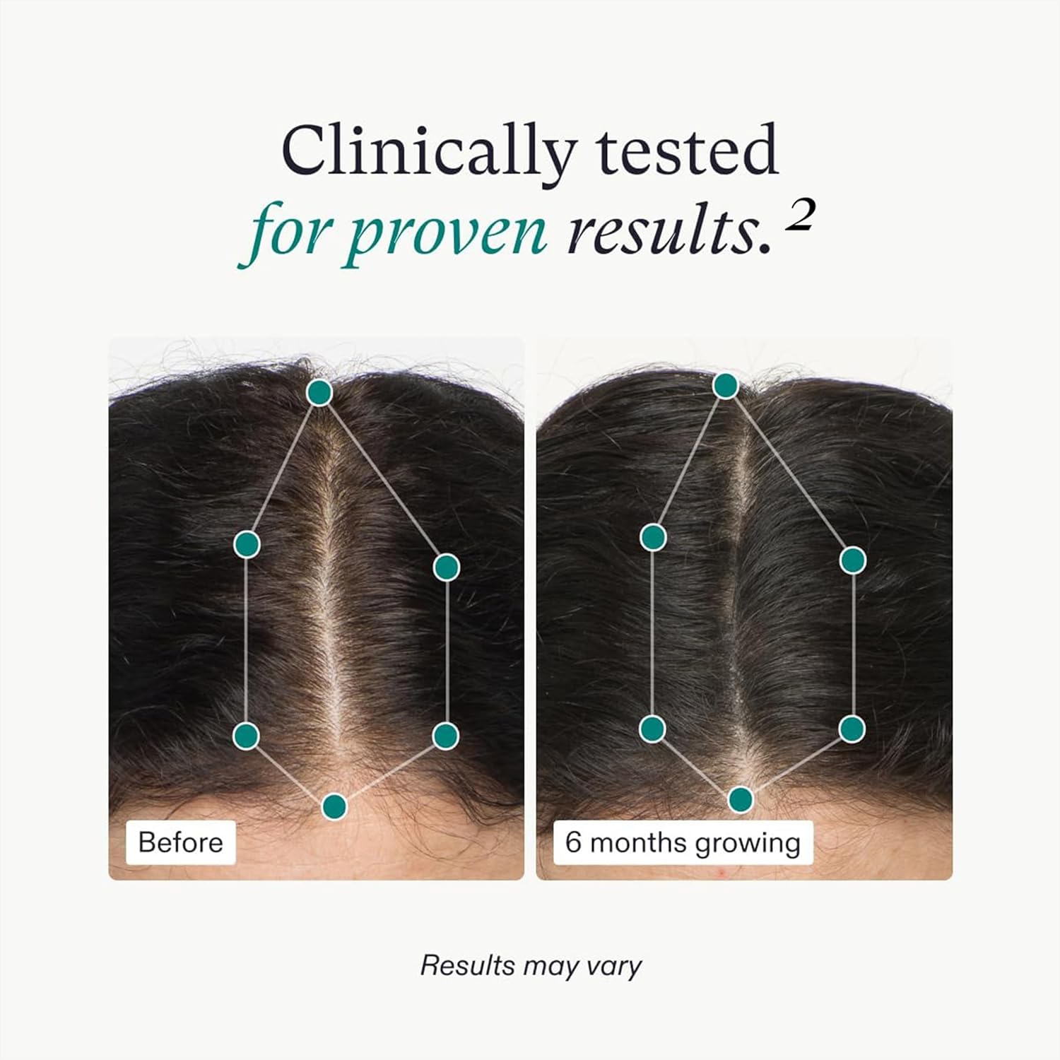 Hair growth clinically tested results chart with before and 6-month scalp photos
