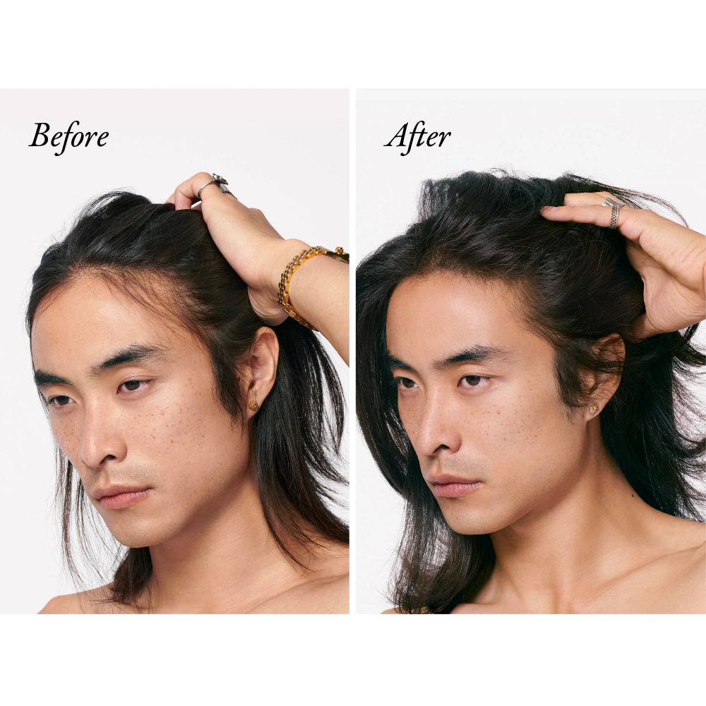 Scalp treatment results: side view hair with fuller-looking scalp coverage